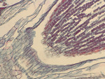 MISSING THUMBNAIL